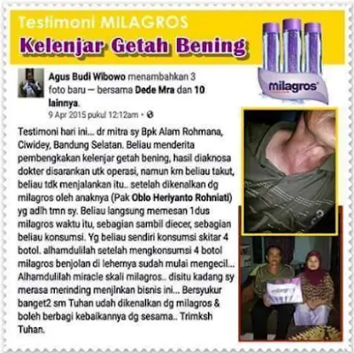 Milagros untuk Kelenjar Getah Bening Benjolan di Leher